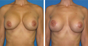 Before & After Photos